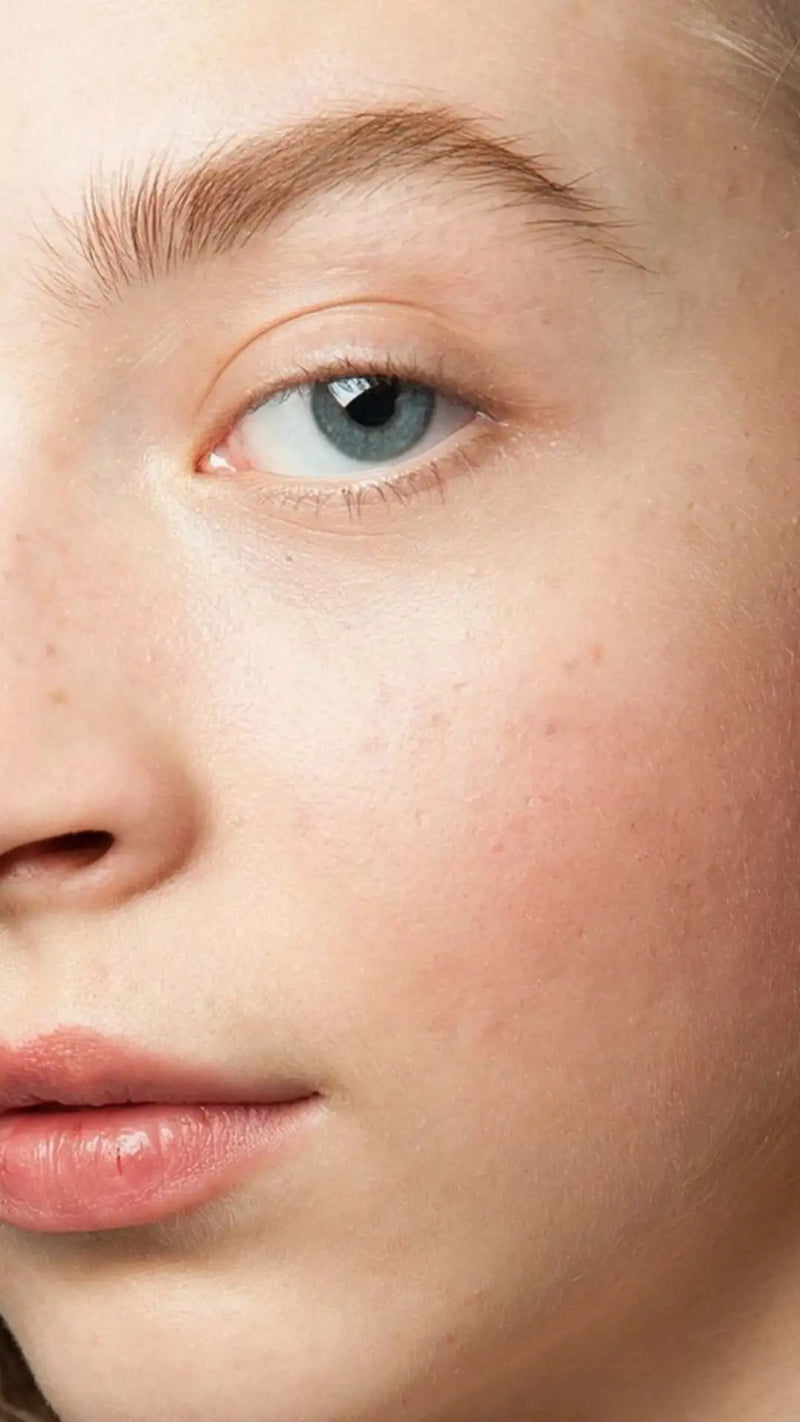 Sensitive skin