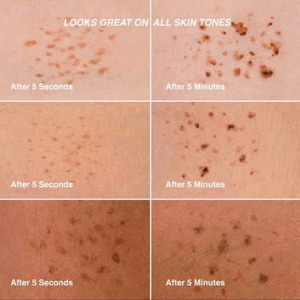 Freck Original Faux Freckles