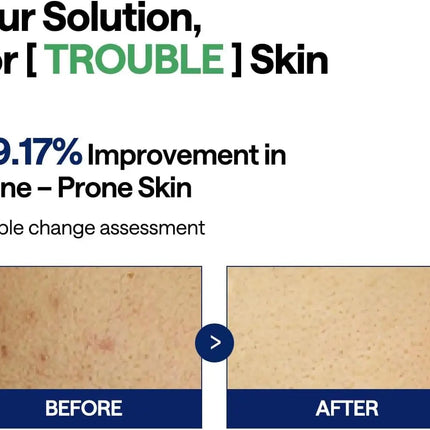 Mediheal Teatree Trouble Pad