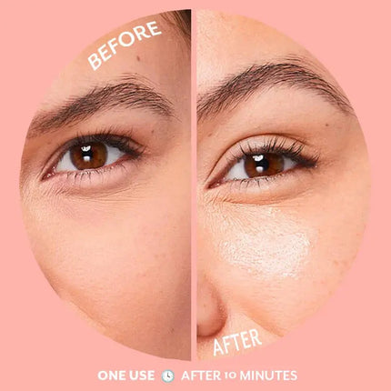 Patchology Serve Chilled Bubbly Eye Gels Single