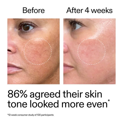 The Inkey List Starter Retinol Serum