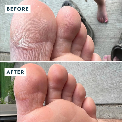 Voesh SoleMate Heel Repair Balm