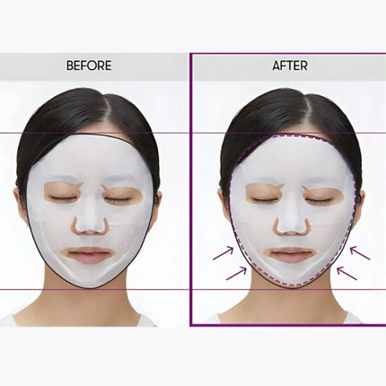 VT Cosmetics Reedle Shot Lifting Mask