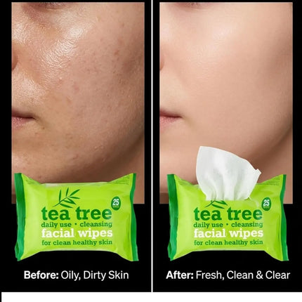 XBC Tea Tree Facial Wipes Twin Pack